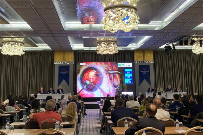 Bursa'da göz cerrahlarından canlı ameliyat